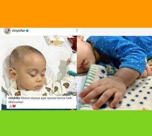 anak lesti kejora sakit hernia